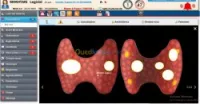 Logiciel médical Endocrinologie 