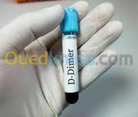 alger-chevalley-algerie-médecine-santé-dosage-des-d-dimères-en-urgence