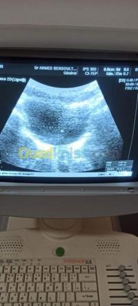 ain-defla-khemis-miliana-algeria-medical-Échographie