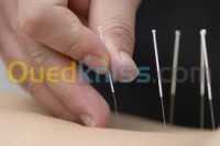 الجزائر-عين-بنيان-خدمات-acupuncture