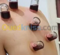 الحجامة الوقائية والعلاجية (رجال) 