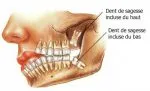 chirurgie dentaire