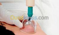 تلمسان-الجزائر-خدمات-hijama-privé