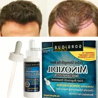 Minoxidil kirkland usa 