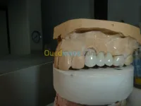 prothese dentaire, soins, odf,