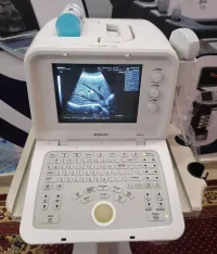 Échographie 