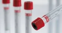 fournisseur consommable de laboratoire 