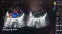 Echographe 