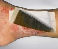 pansement anti escarre VLIWAKTIUV + Ag au charbon contre les odeurs 