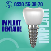 medecine-sante-implant-dentaire-el-khroub-constantine-algerie