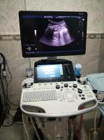 medical-echographe-ge-logiq-s8-biskra-algerie