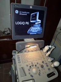 Echographe Ge P6