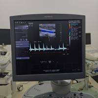 medical-echographe-siemens-s2000-ain-smara-constantine-algerie