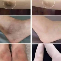 مبيض الفوري الطبيعي 