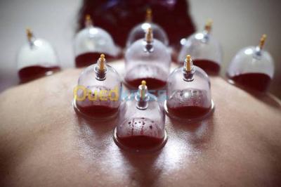 oran-algerie-médecine-santé-hijama