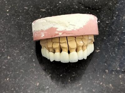 medecine-sante-assistante-dentaire-polyvalente-bordj-el-kiffan-alger-algerie