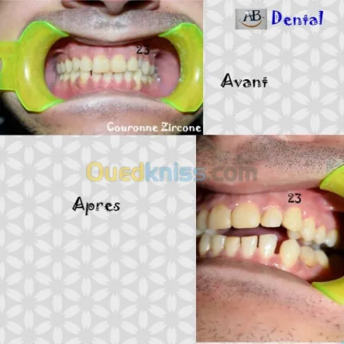 Dentiste  spécialiste