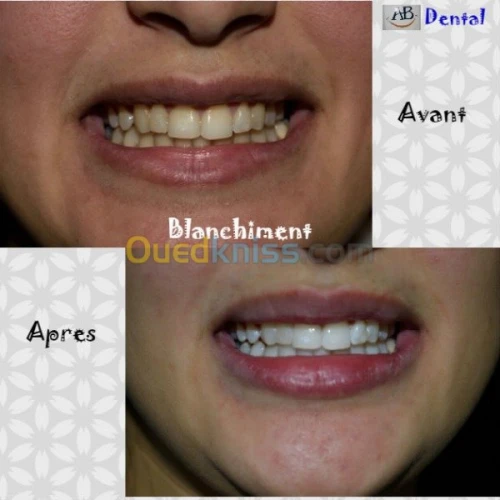 Dentiste  spécialiste