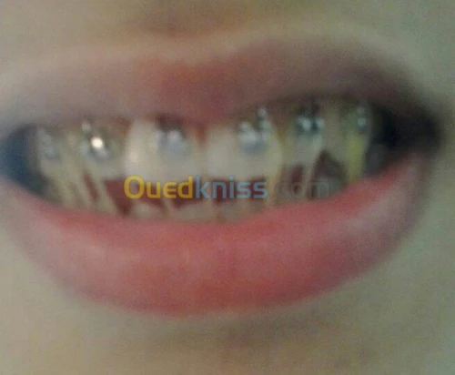 Chirurgien dentiste