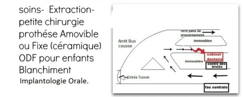 Implantologie Dentaire
