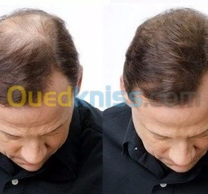 TOPPIK 100 % ORIGINALE √ عرض خاص