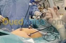 جراحة عامة و ختان الاطفال-Circoncision