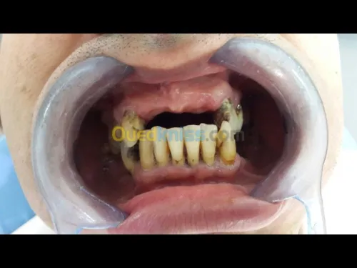Dentisterie esthétique 
