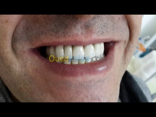 Dentisterie esthétique 