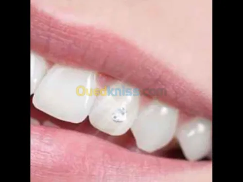 Dentisterie esthétique 