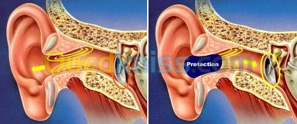 Protection auditive Bouchon anti bruit