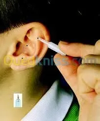 Nutrition  Auriculotherapie  chromato