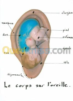 Nutrition  Auriculotherapie  chromato