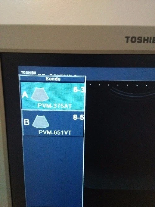Echographe nemio xg