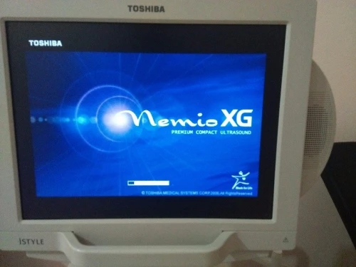 Echographe nemio xg