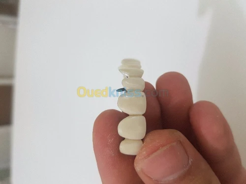 La prothese dentaire