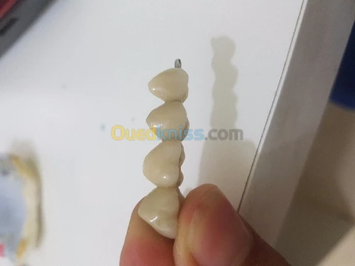 La prothese dentaire