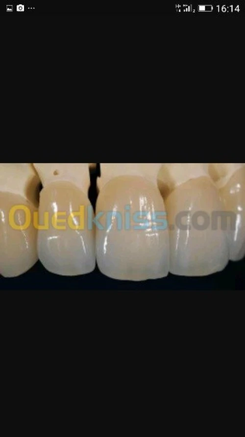 Complet haut et bas ,céramique, zircon