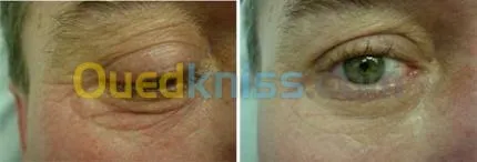 Médecine esthétique et Mesotherapie  