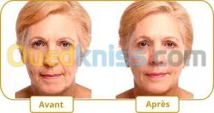 Médecine esthétique et Mesotherapie  