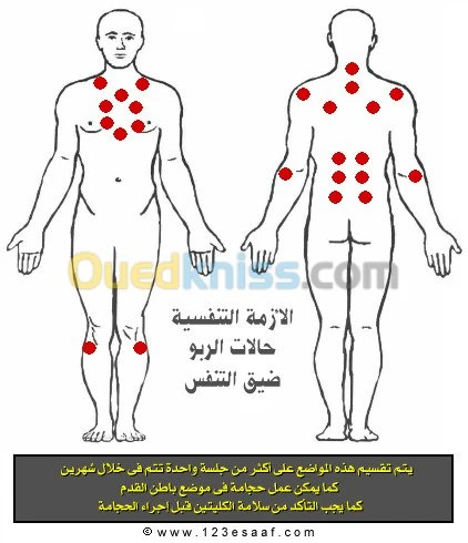 Hijama,consultations,soins à domicile 