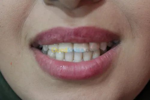 chirugien dentiste 