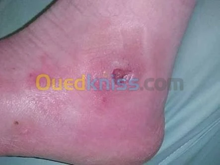 Soins à domicile