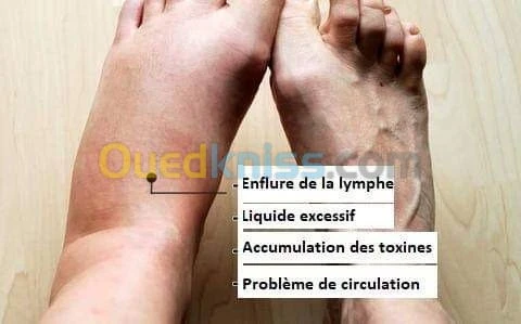 Drainage Lymphatique التصريف اللمفاوي