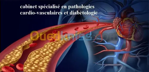 cardiologie - diabete 