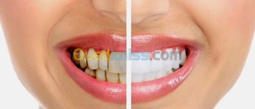 CLINIQUE ELITE DENTAIRE