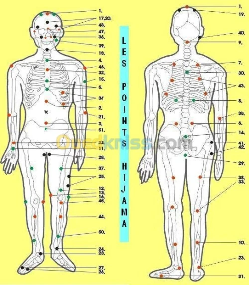 HIJAMA et MESOTHERAPIE...Urgences..