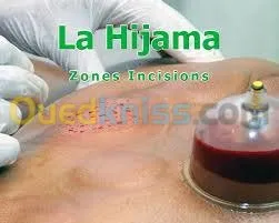 medecin  fait l' hijama a domicil