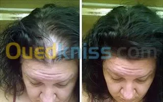 TOPPIK-CABOKI 27.5/30g منتج تجميلي