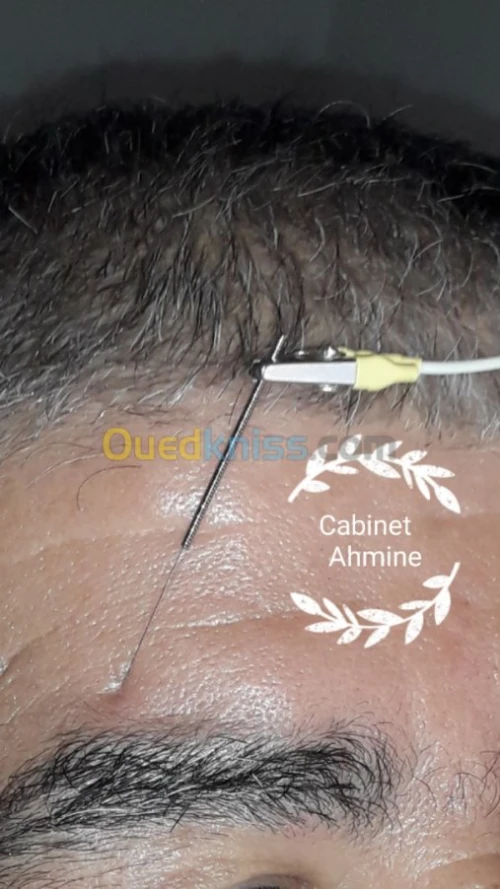 KINESITHERAPIE ACUPUNCTURE RÉÉDUCATION