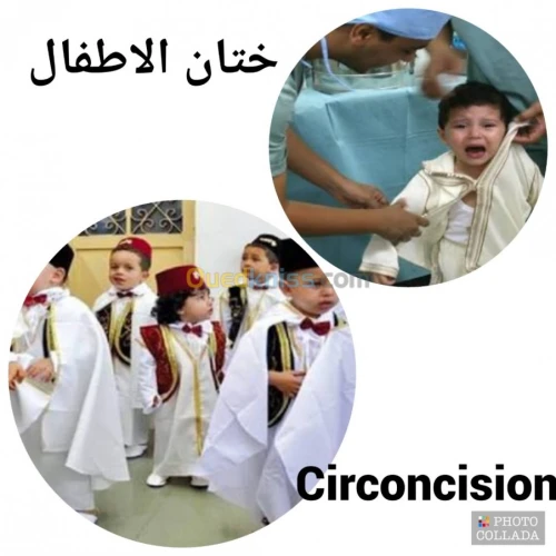 ختان الاطفال